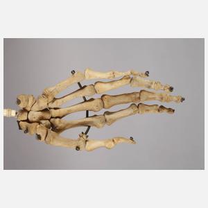 Außergewöhnlicher Rückenkratzer