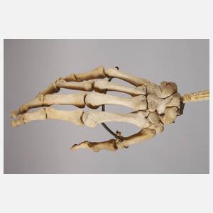 Außergewöhnlicher Rückenkratzer