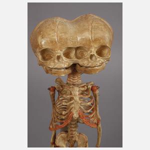 Zwei anatomische Modelle