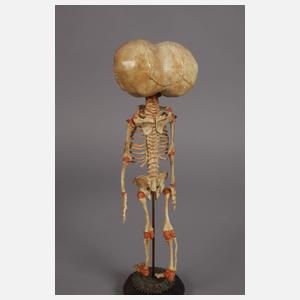 Zwei anatomische Modelle