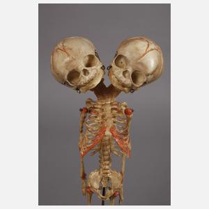 Zwei anatomische Modelle