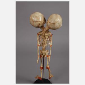 Zwei anatomische Modelle