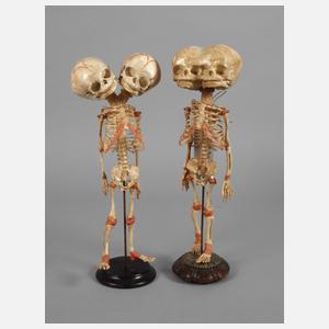 Zwei anatomische Modelle