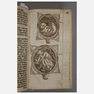 Der schwangern Weibs-Personen Hülff-Leistung 1687