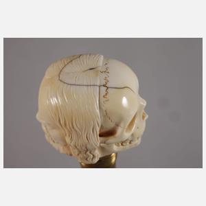 Spazierstock mit Vanitasmotiv