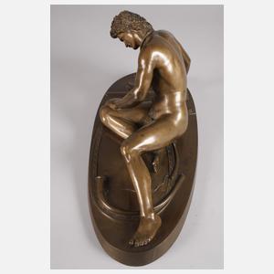 Antikenrezeption sterbenden Gallier