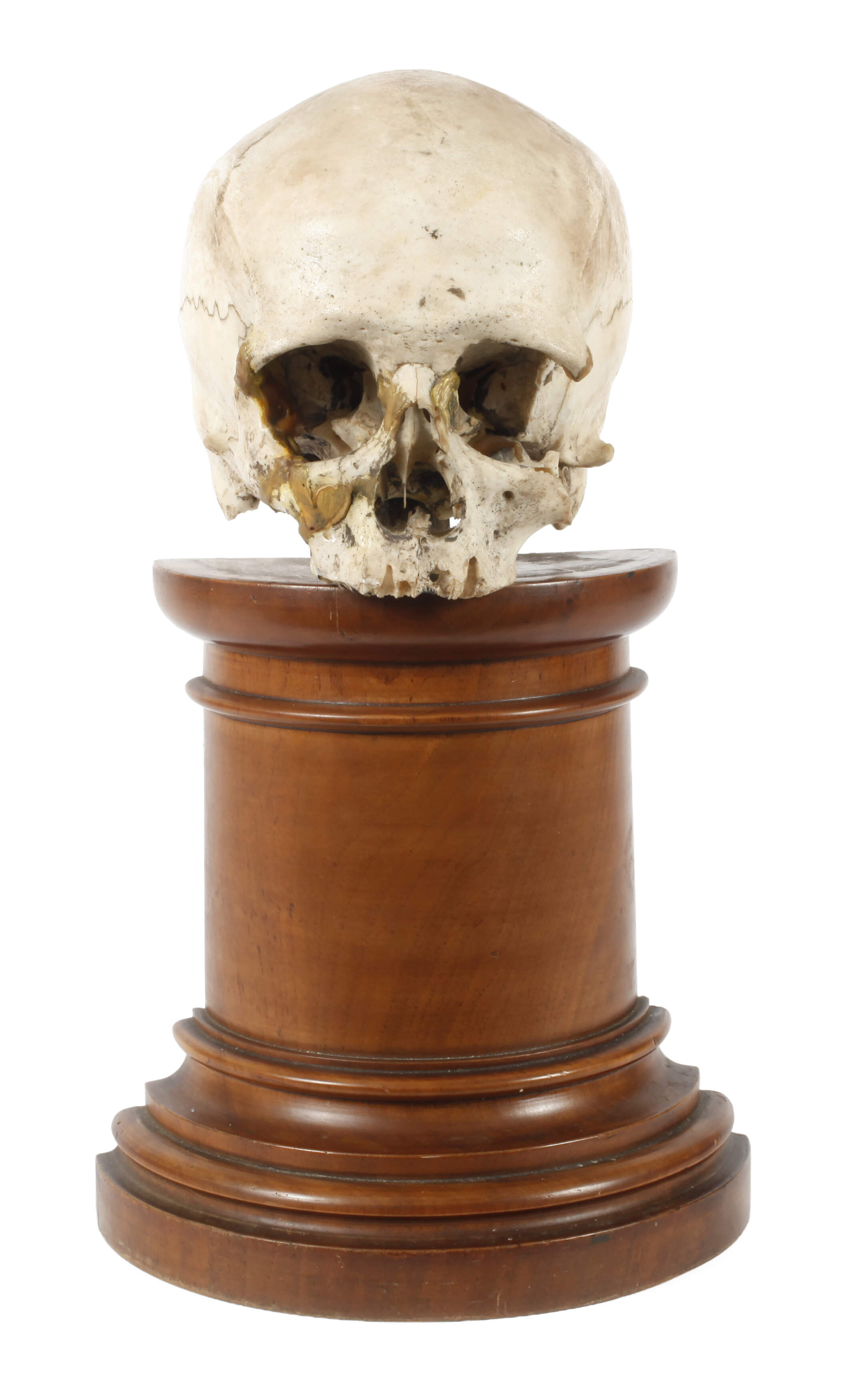 Memento mori