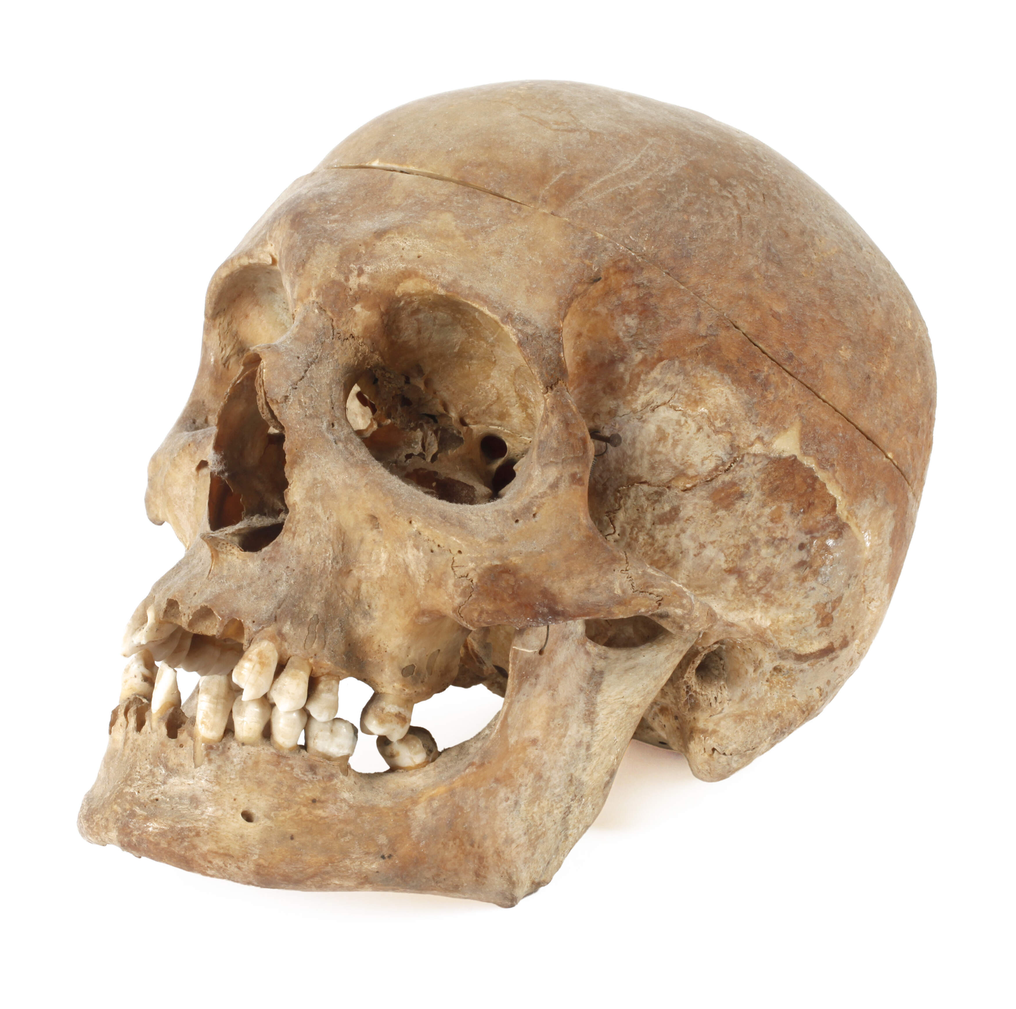 Anatomisches Anschauungsmodell