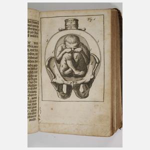 Neues Hebammen-Licht 1728