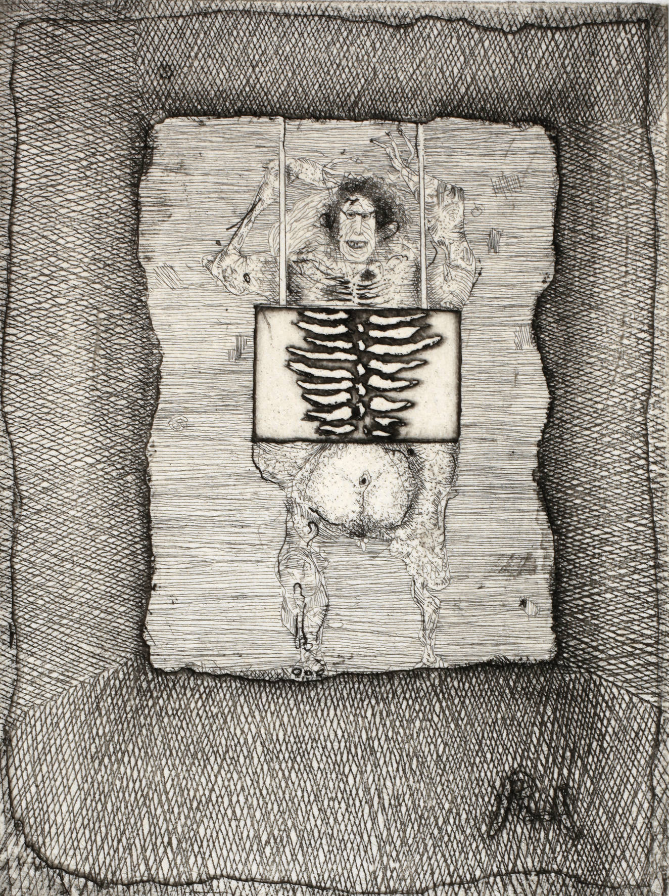 Prof. Paul Wunderlich, ”X-Ray”