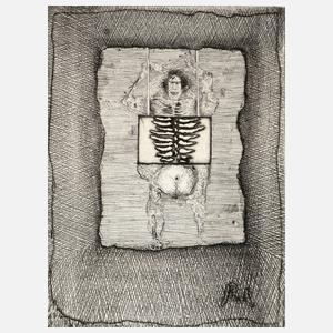 Prof. Paul Wunderlich, ”X-Ray”