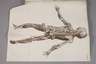 Loders Anatomie-Atlas um 1800