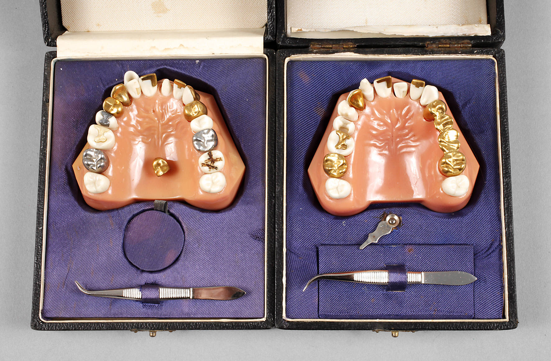 Zwei Dentalmodelle
