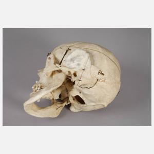 Menschlicher Schädel