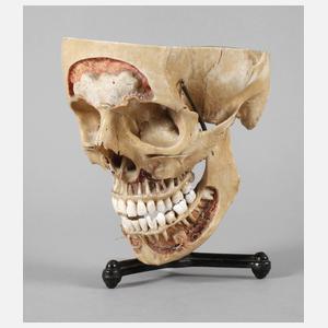 Lehrmodell Schädel
