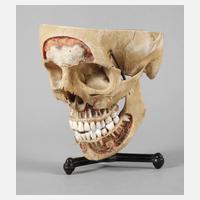 Lehrmodell Schädel111