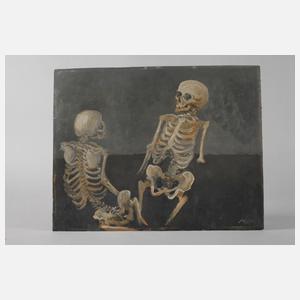 Thilo Maatsch, Zwei Gerippe