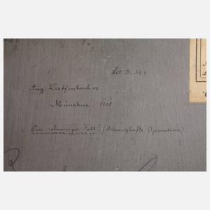 Dieffenbacher, "Ein schwieriger Fall"